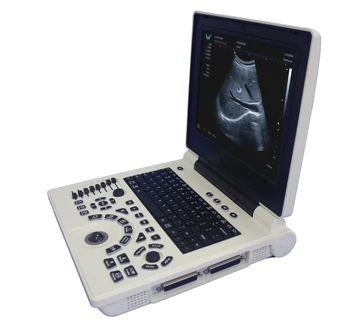 Диагностична система на Безжичната сонда-скенер Медицински ултразвук мобилен за бременни жени преносим ултразвук
